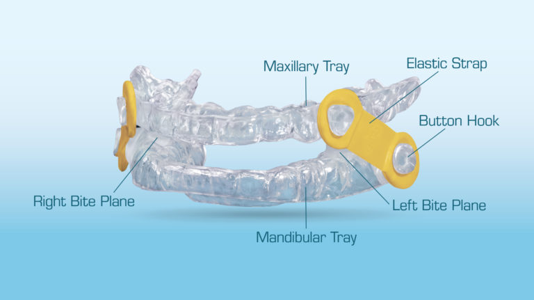 The EMA® Appliance: A Tried-and-True Snoring Solution| New West