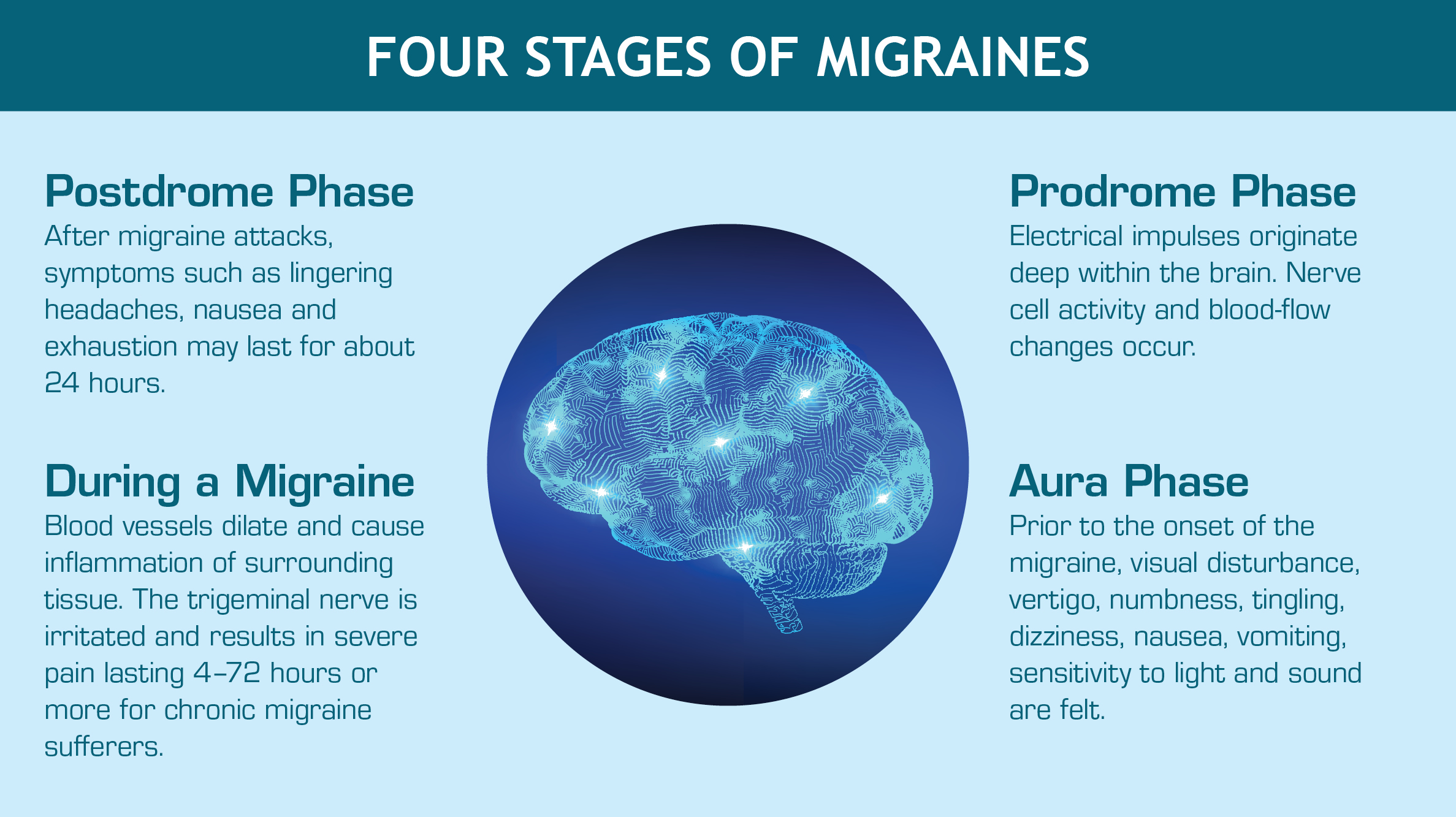 Four Stages of Migraines