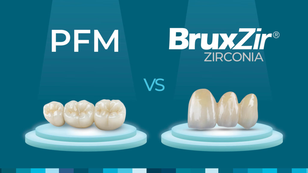 Zirconia Versus PFMs: Which Should You Crown the Winner?