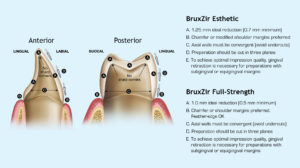 How to Prep and Cement BruxZir® Zirconia Crowns | New West