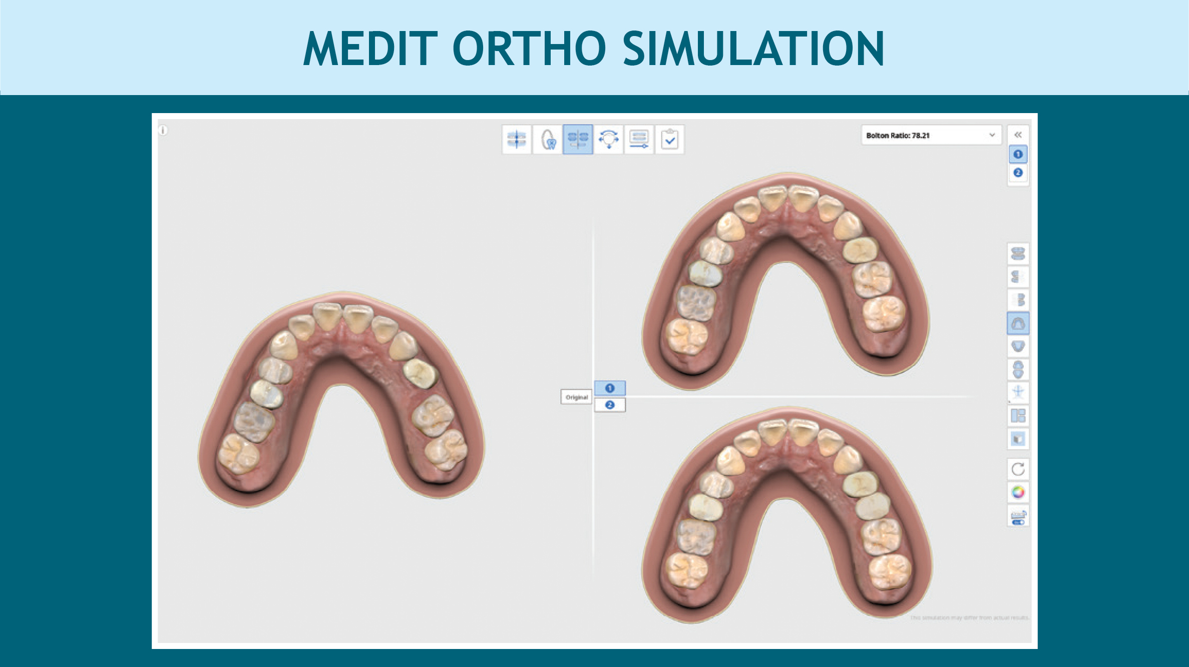 medit ortho simulation app image