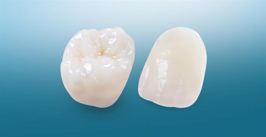 IPS e.max - New West Dental Ceramics