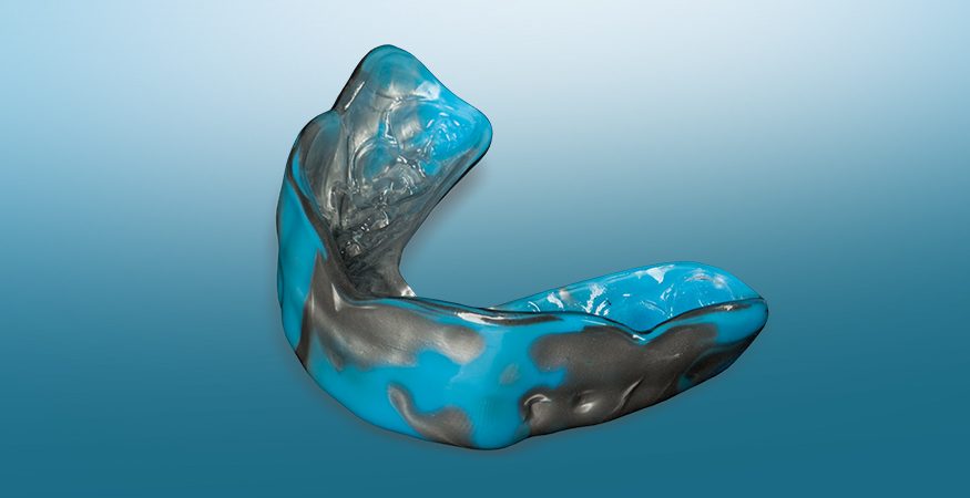 Playsafe Mouthguards -New West Dental Ceramics
